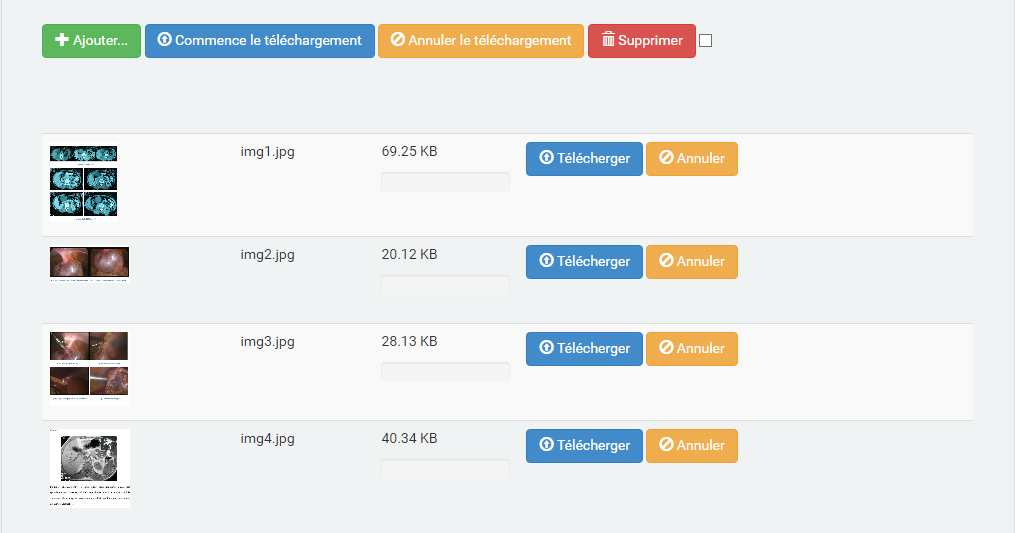 etape 1